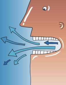 Mouth Breathing